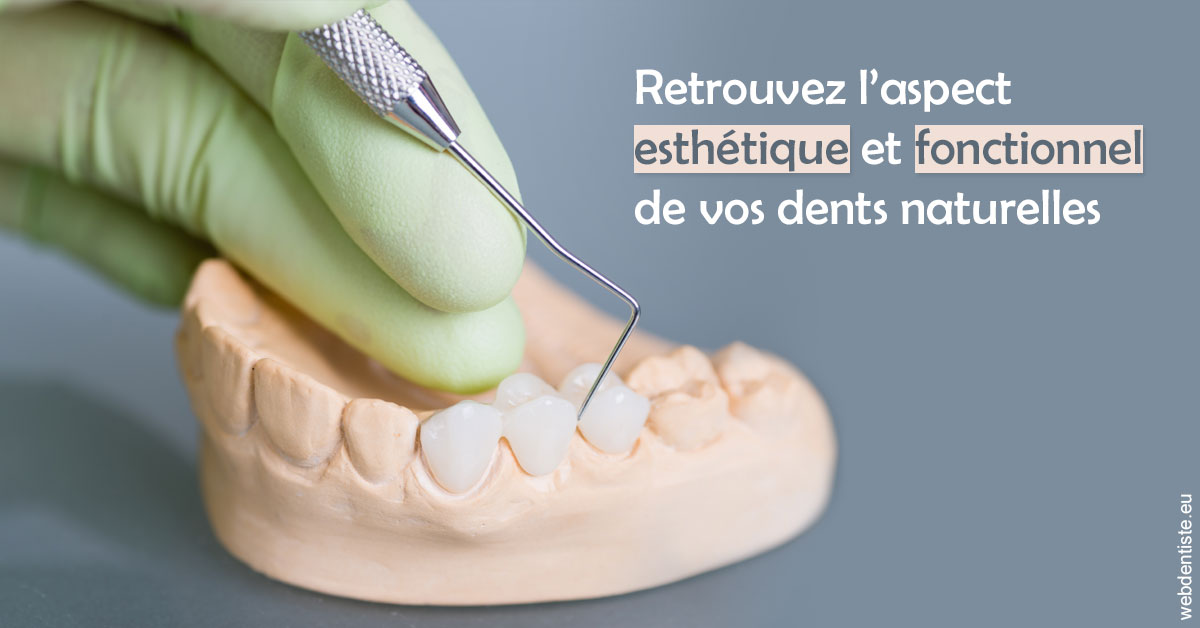 https://dr-bauer-patrick.chirurgiens-dentistes.fr/Restaurations dentaires 1
