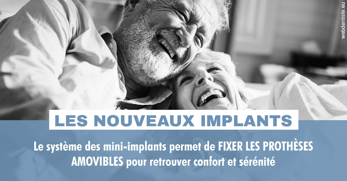 https://dr-bauer-patrick.chirurgiens-dentistes.fr/Les nouveaux implants 2
