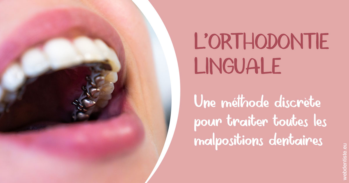 https://dr-bauer-patrick.chirurgiens-dentistes.fr/L'orthodontie linguale 2