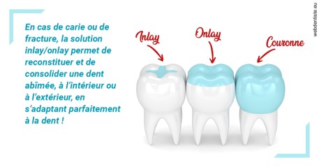 https://dr-bauer-patrick.chirurgiens-dentistes.fr/L'INLAY ou l'ONLAY