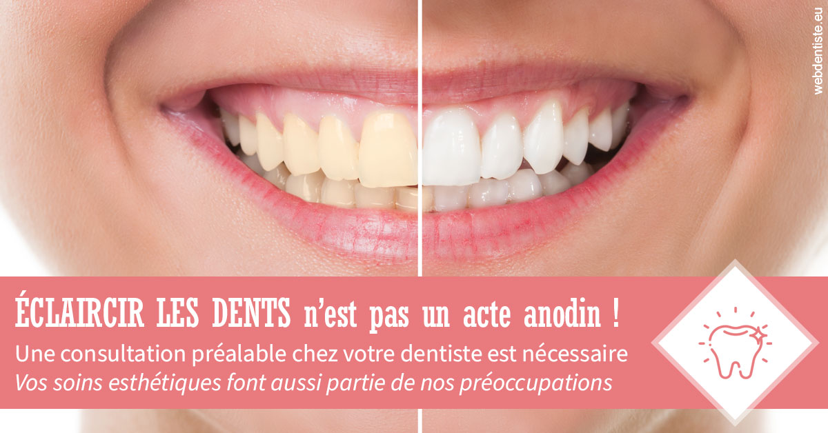 https://dr-bauer-patrick.chirurgiens-dentistes.fr/Eclaircir les dents 1
