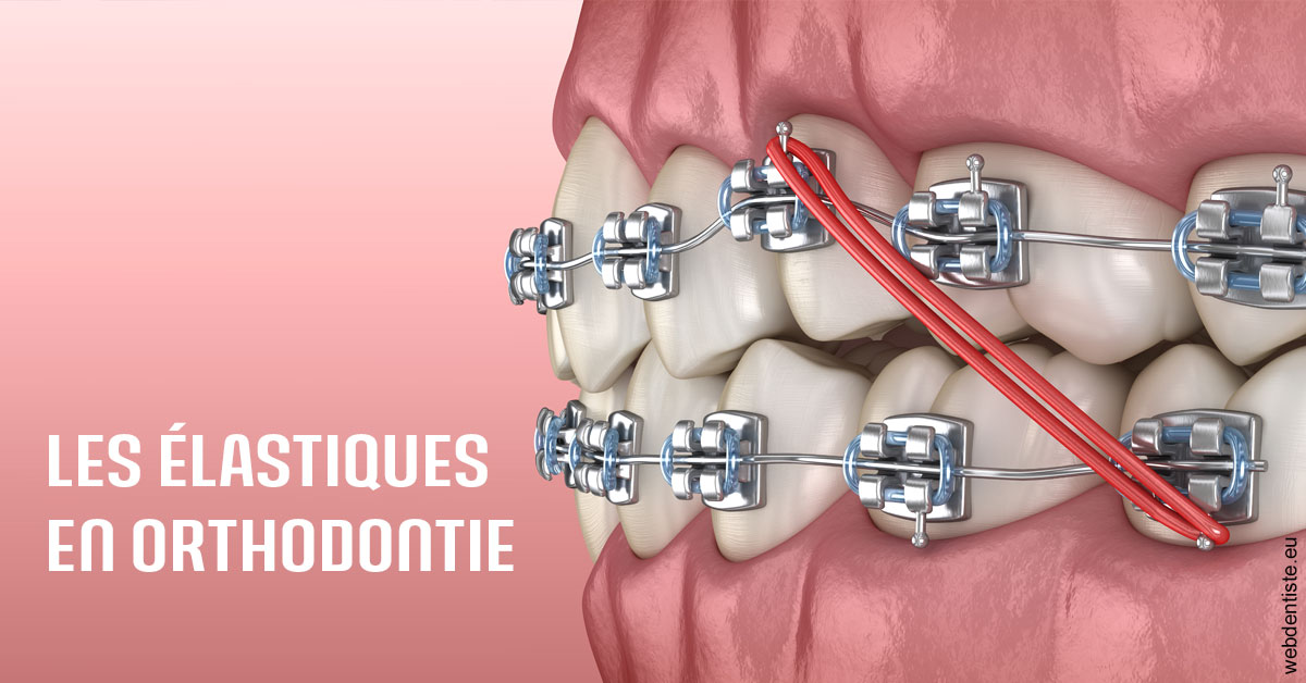 https://dr-bauer-patrick.chirurgiens-dentistes.fr/Elastiques orthodontie 2