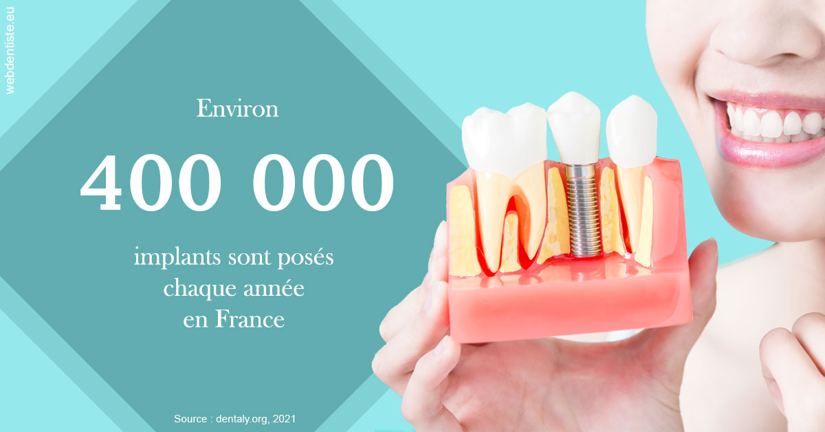 https://dr-bauer-patrick.chirurgiens-dentistes.fr/Pose d'implants en France 2
